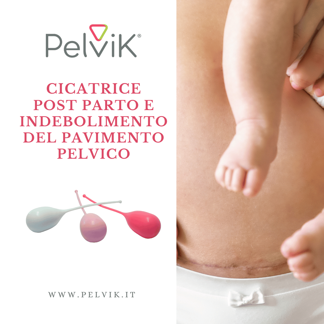 pavimento pelvico debole post partum